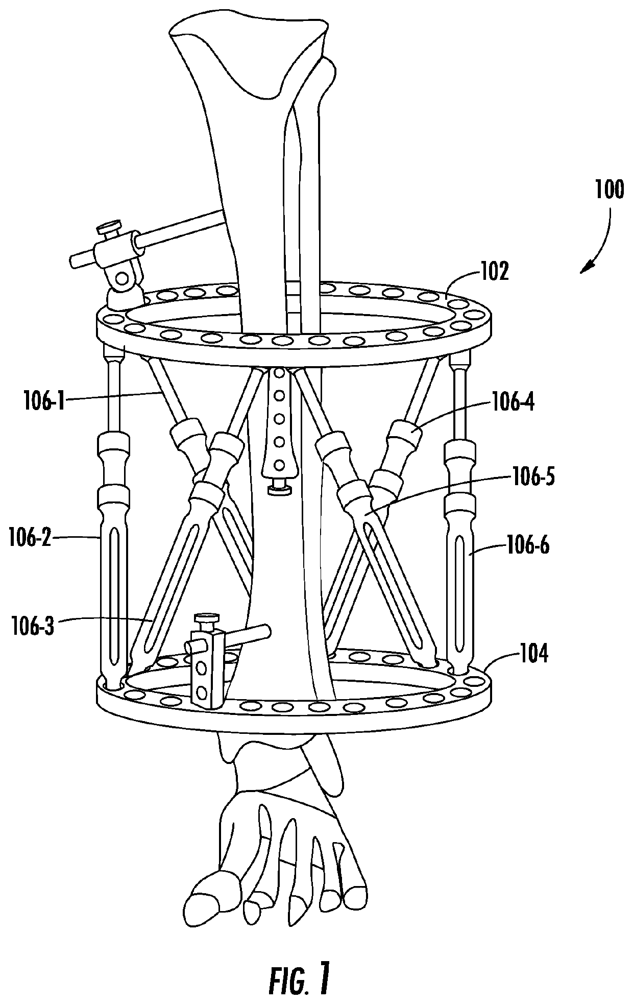 Device for external fixation strut measurement and real-time feedback