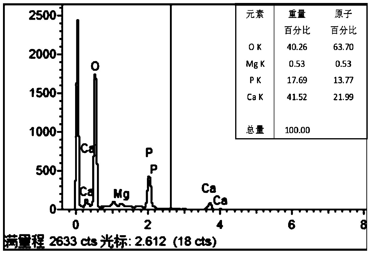 A kind of preparation method of magnesium alloy surface micro-arc electrophoresis containing ha biocomposite film layer