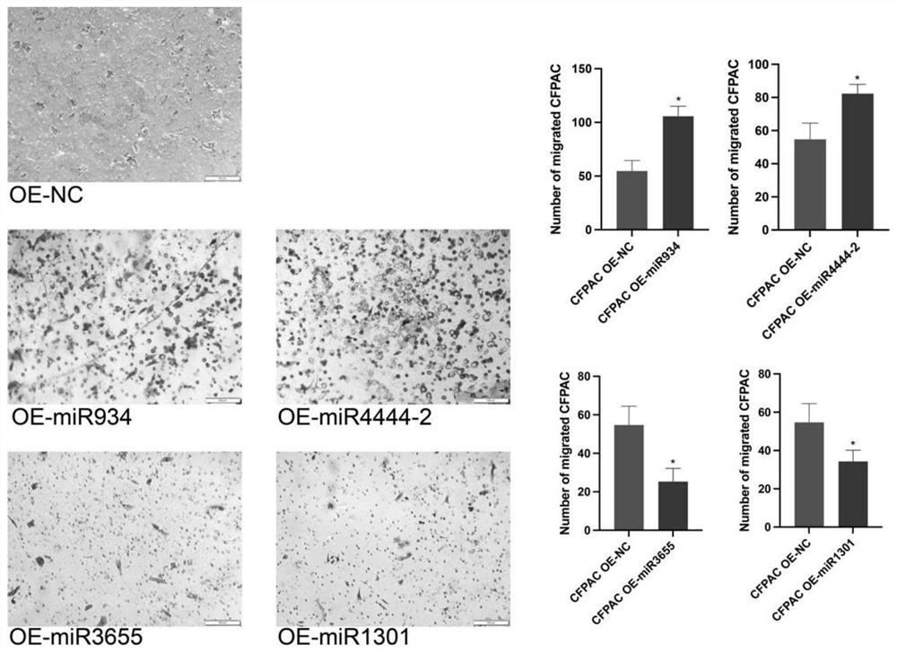 Kit for detecting prognosis condition of pancreatic cancer