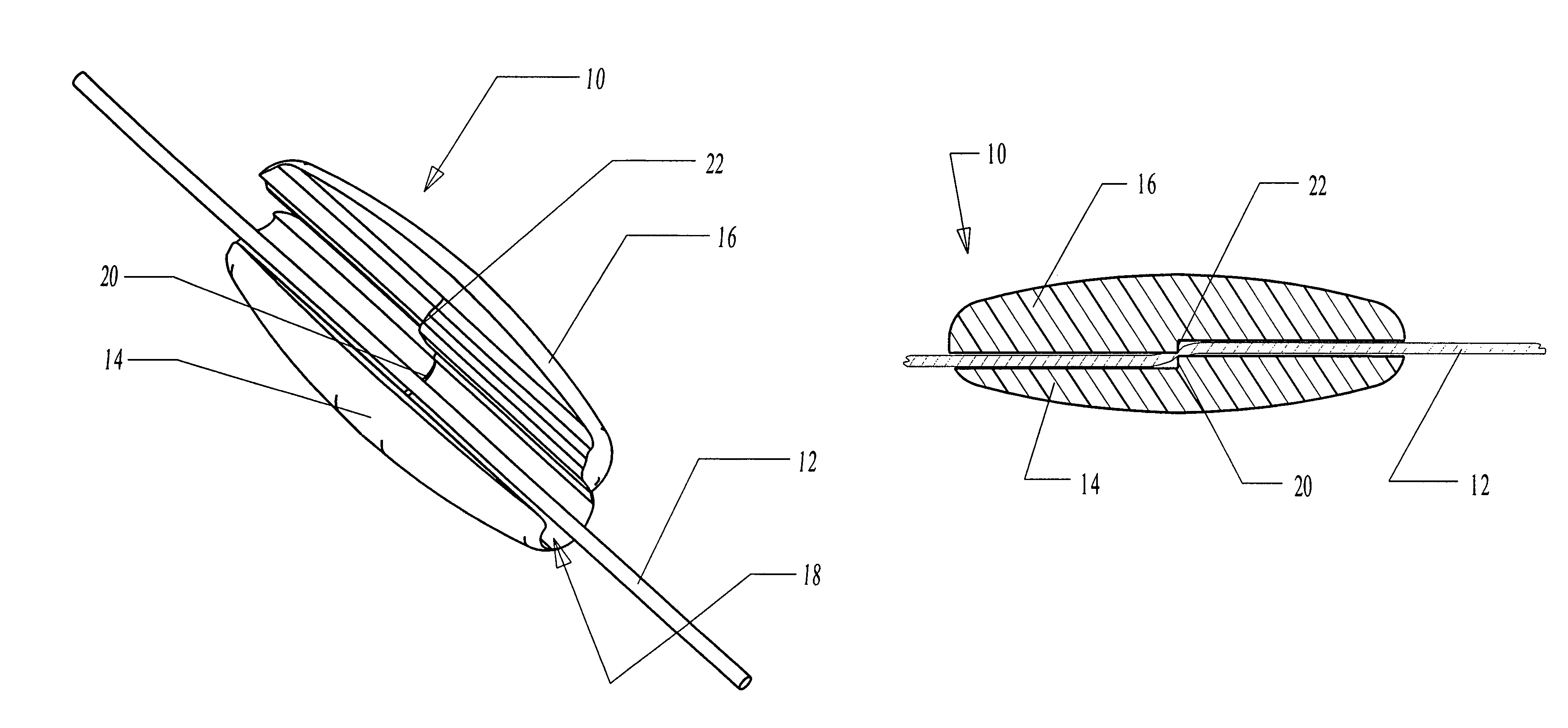 Bead attachment