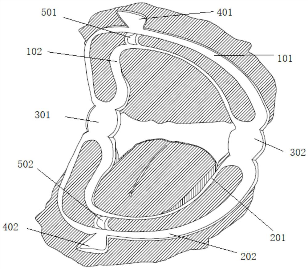 Mouth gag for full-mouth planting