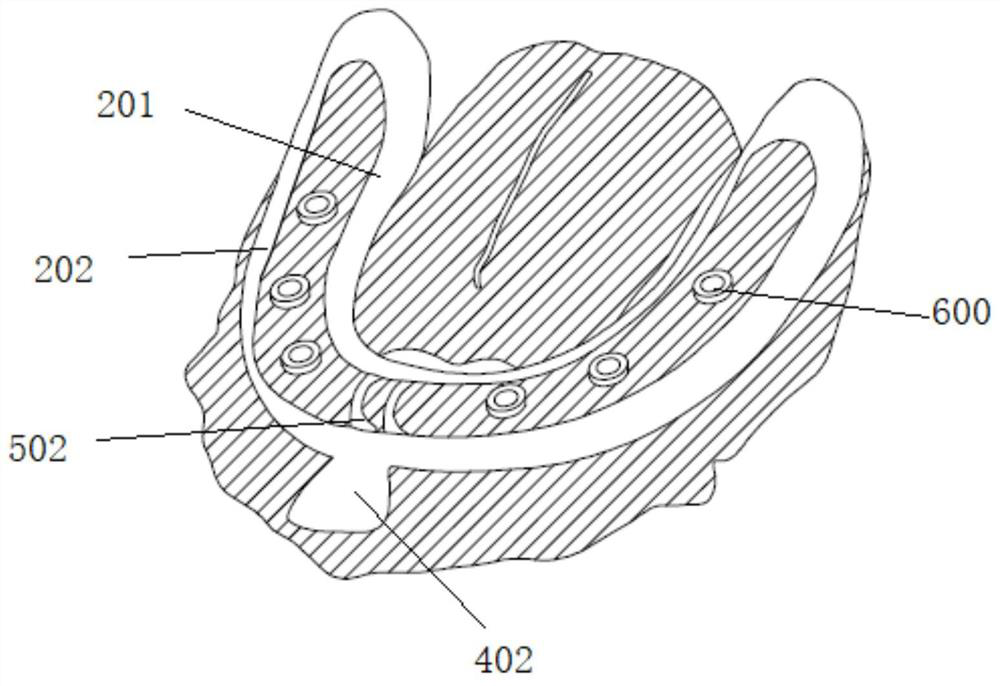 Mouth gag for full-mouth planting