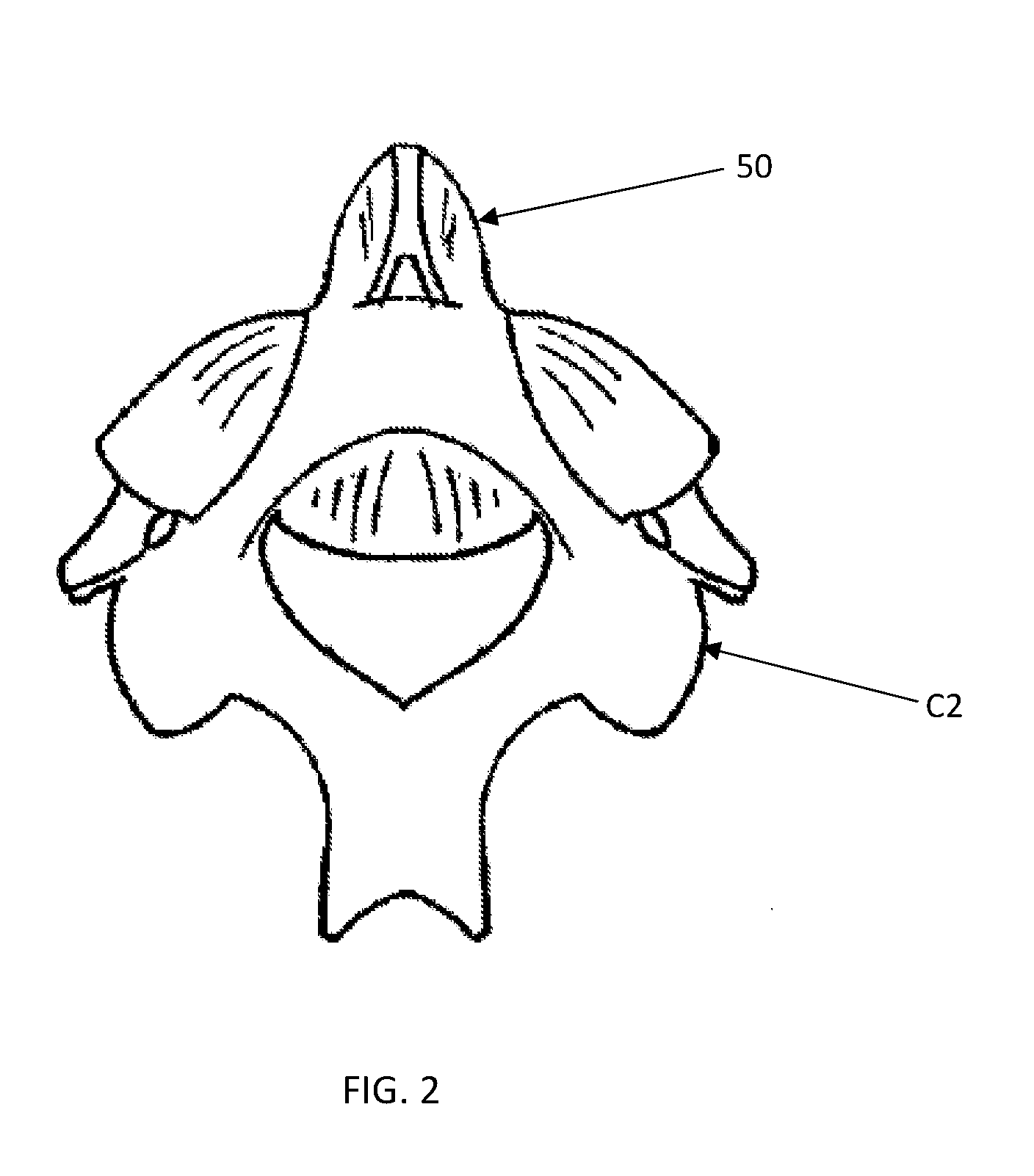 Odontoid bullet