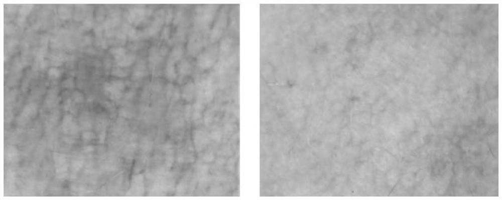 A traditional Chinese medicine composition for eliminating wind and detoxification and preparation method thereof