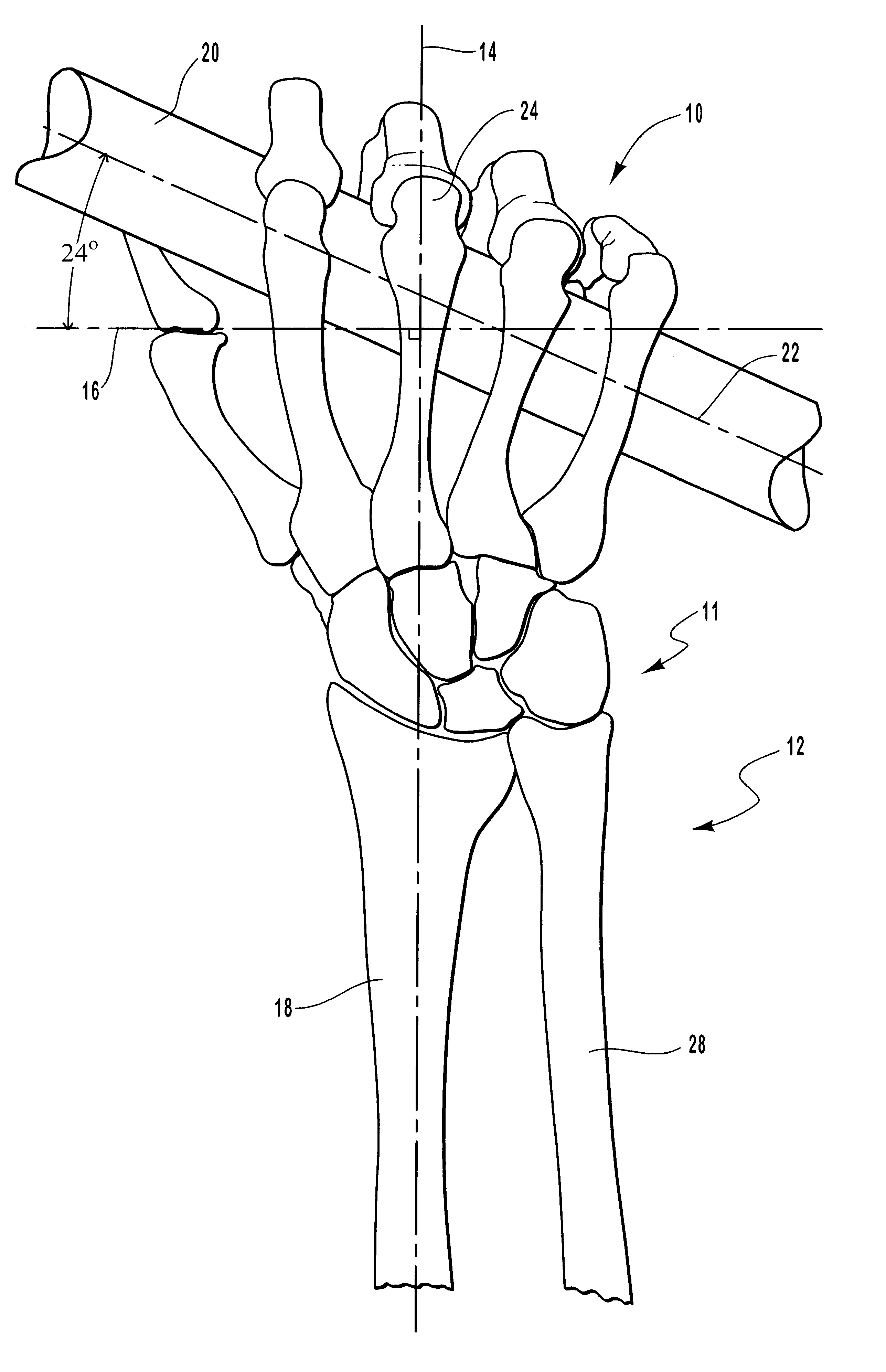 Ergonomic paddle grip