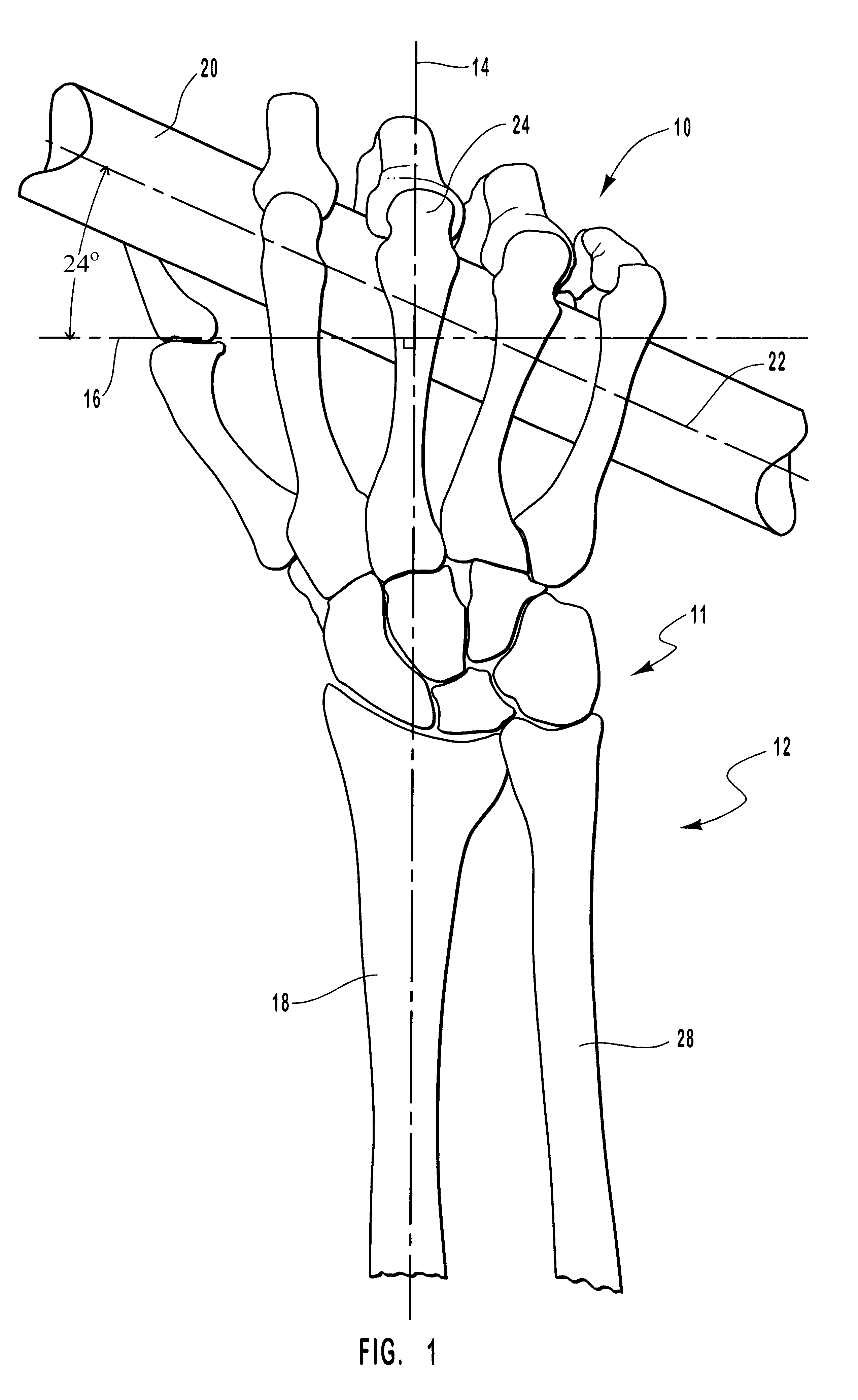 Ergonomic paddle grip