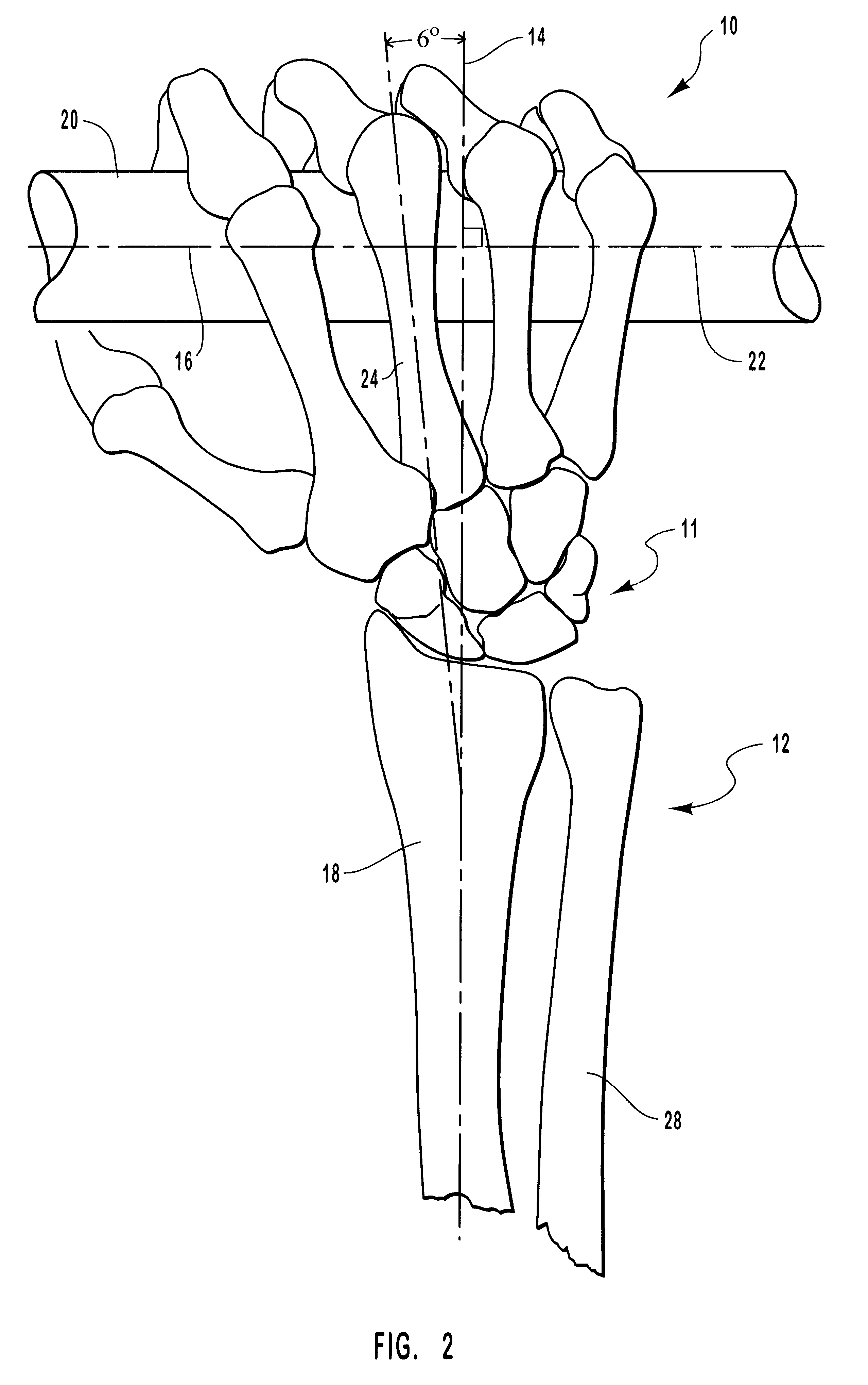 Ergonomic paddle grip