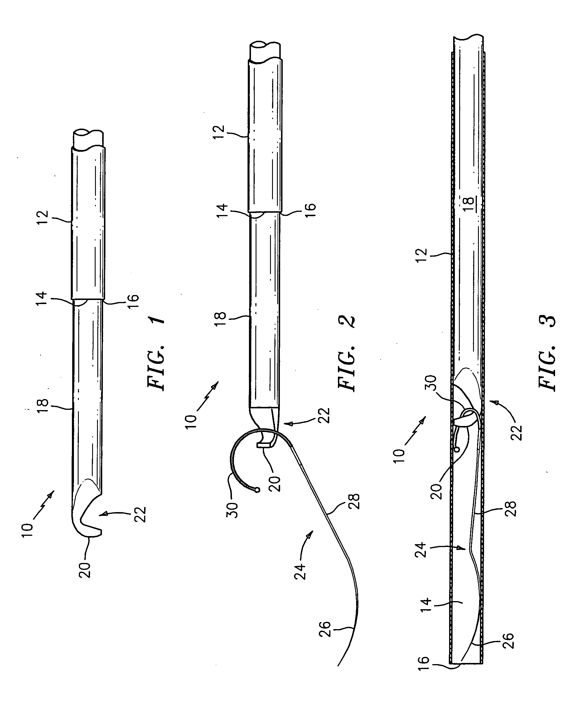 Hooked rod delivery system for use in minimally invasive surgery