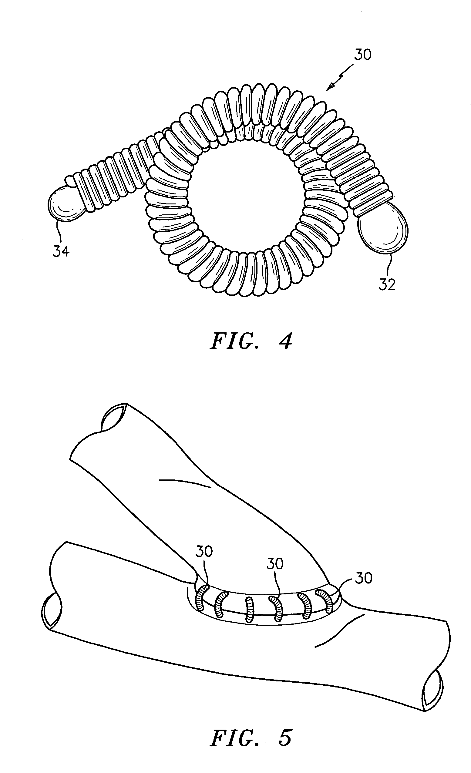 Hooked rod delivery system for use in minimally invasive surgery