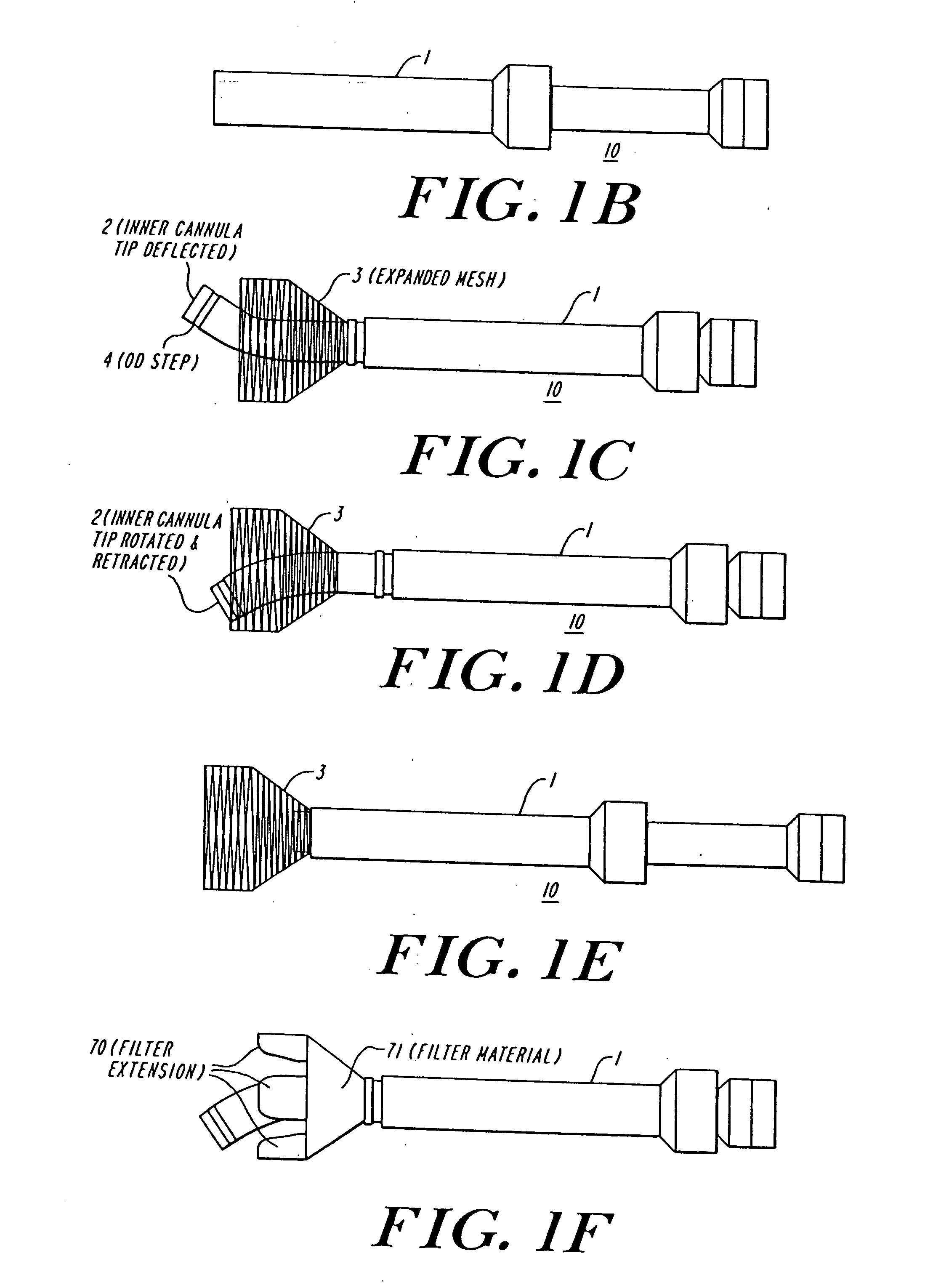 Cardiac valve procedure methods and devices