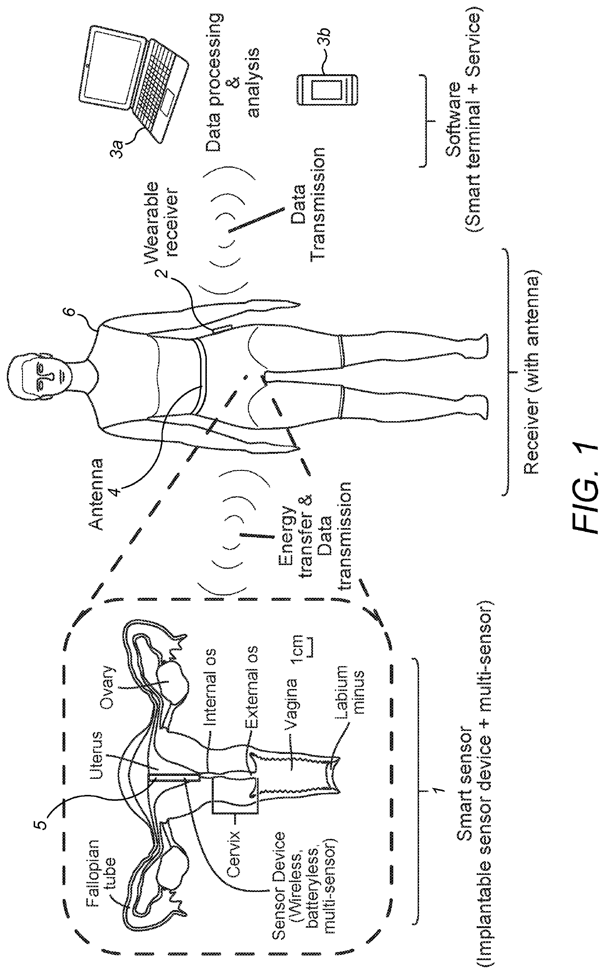 Wearable antenna and intra-uterine monitoring system