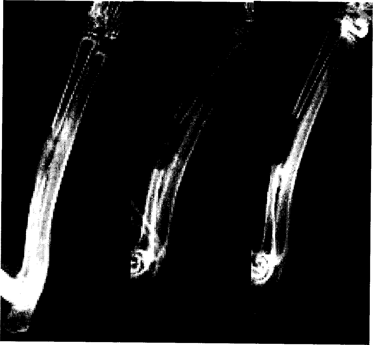 Injected tissue engineering bone and its constrction and application