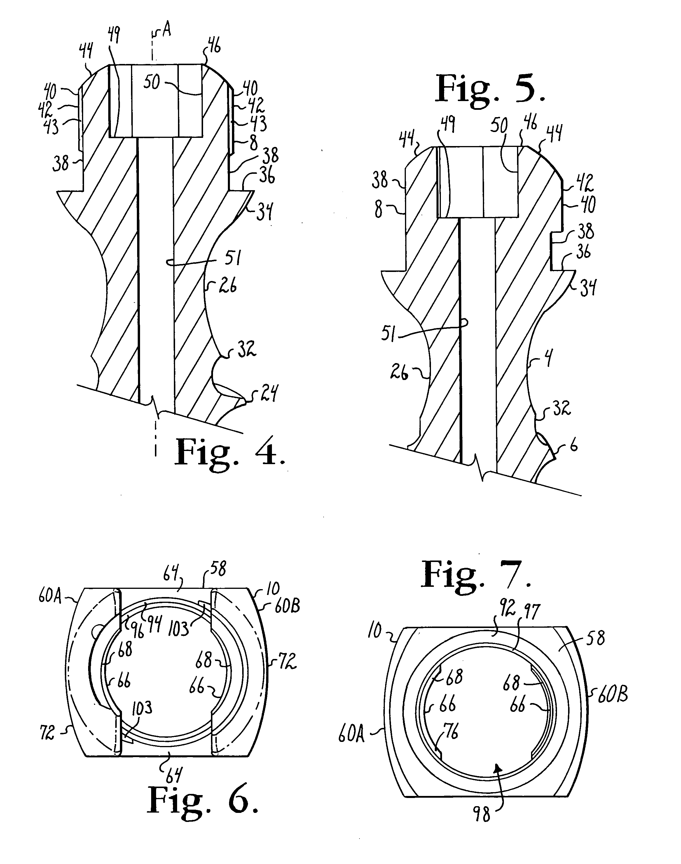 Polyaxial bone screw with cam connection and lock and release insert