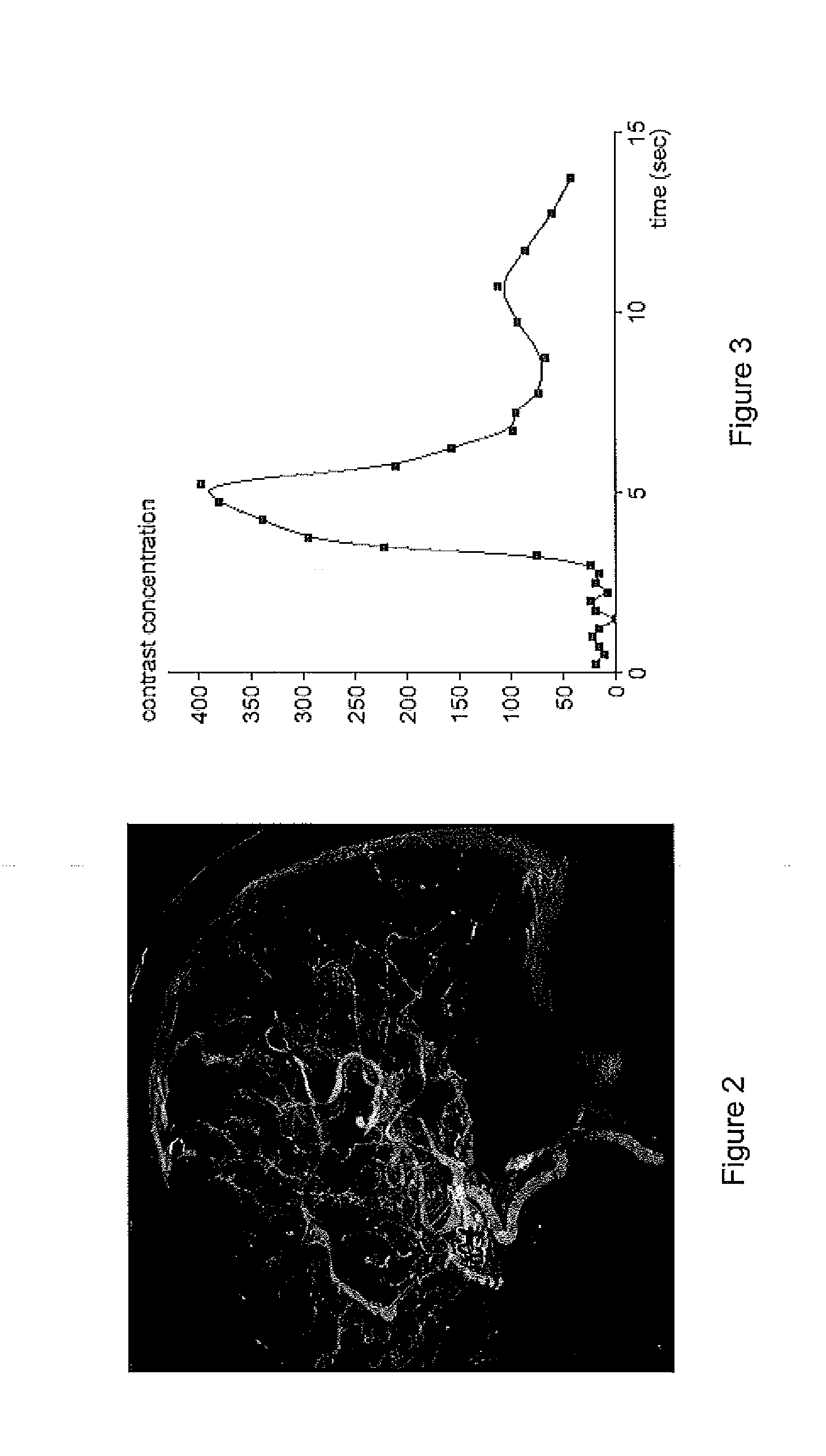 System for Providing Digital Subtraction Angiography (DSA) Medical Images