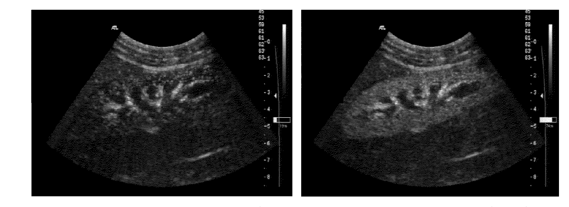 Method for generating quantitative images of the flow potential of a region under investigation