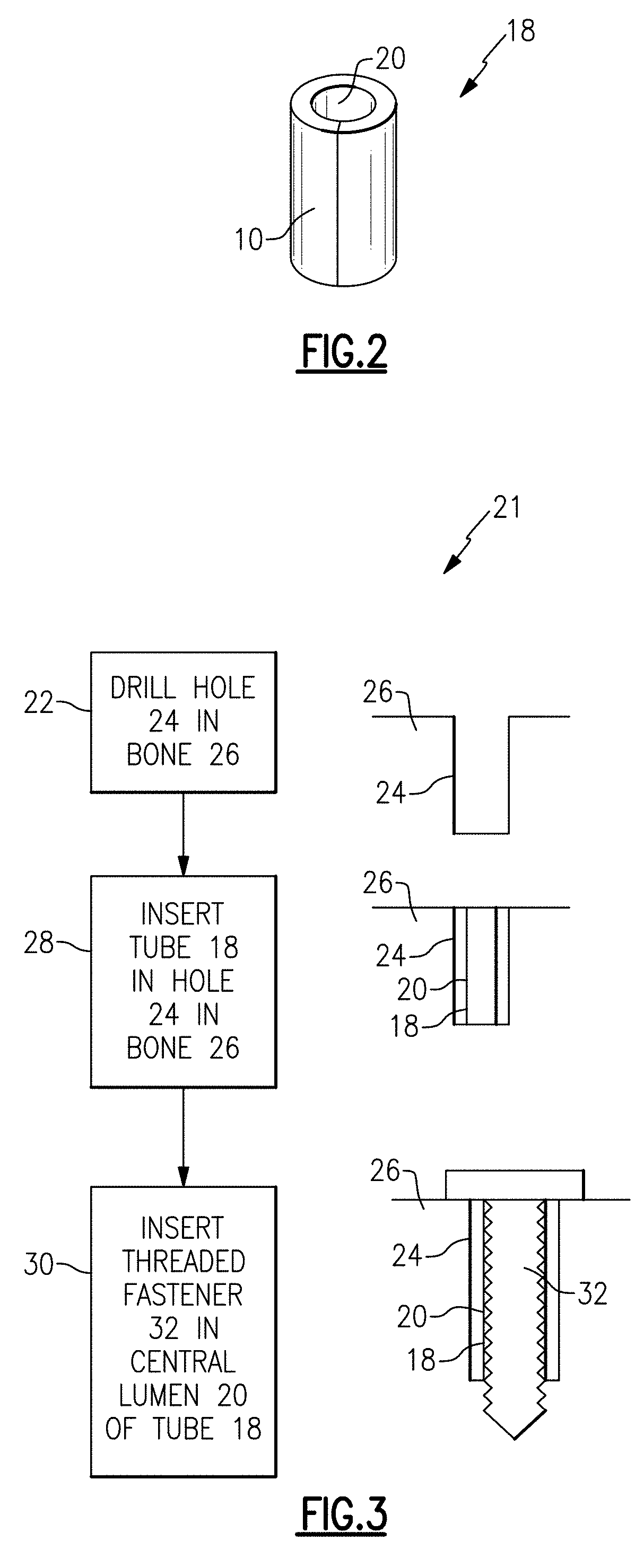 Three dimensional spacer fabric to increase the holding power of screws