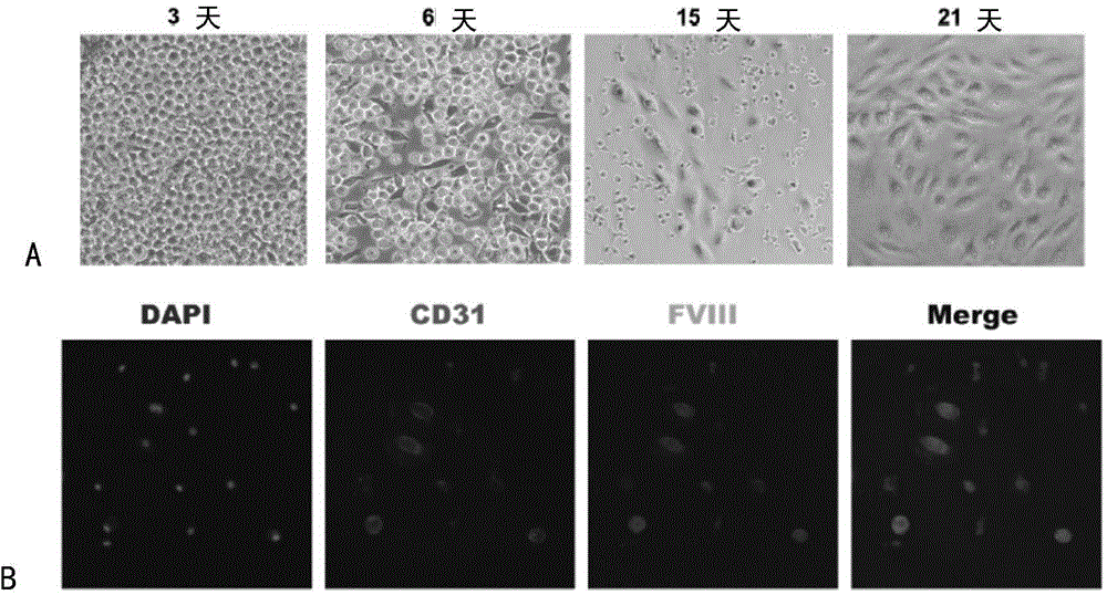 Efficient amplification culture system for human vascular endothelial progenitor cells