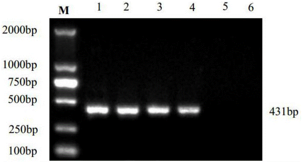 Virus-elimination method of plant tissue cultured virus-free explant