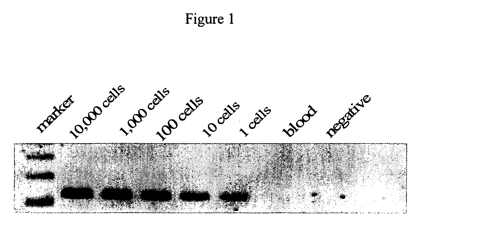 Enhanced diagnostic potential of prostate-specific antigen expressing cells