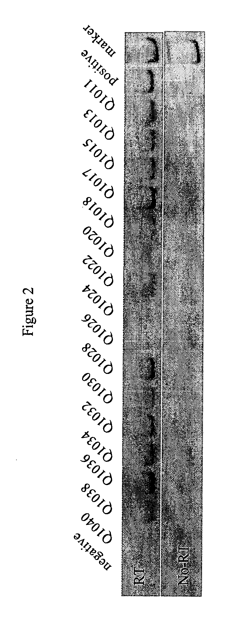 Enhanced diagnostic potential of prostate-specific antigen expressing cells