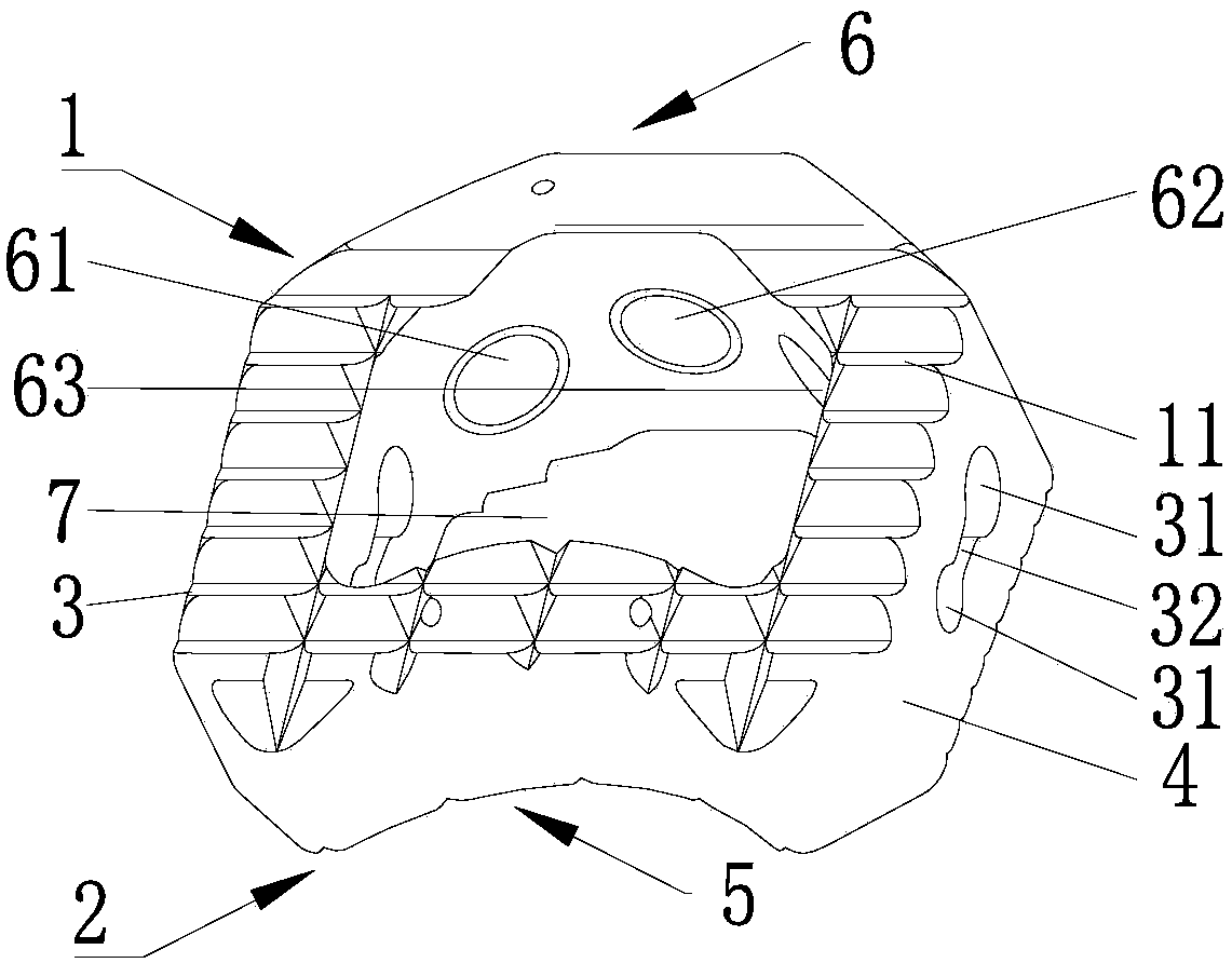 Anterior lumbar vertebra interbody fusion cage for interbody fusion