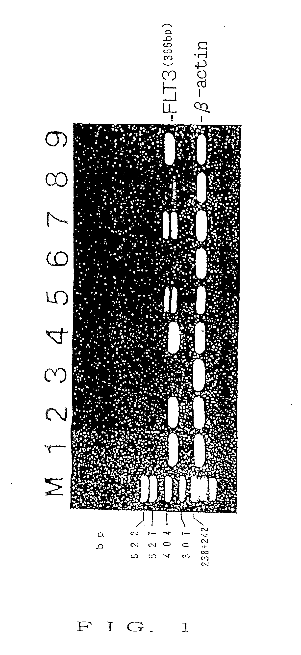 Nucleic acid encoding receptor type protein kinase