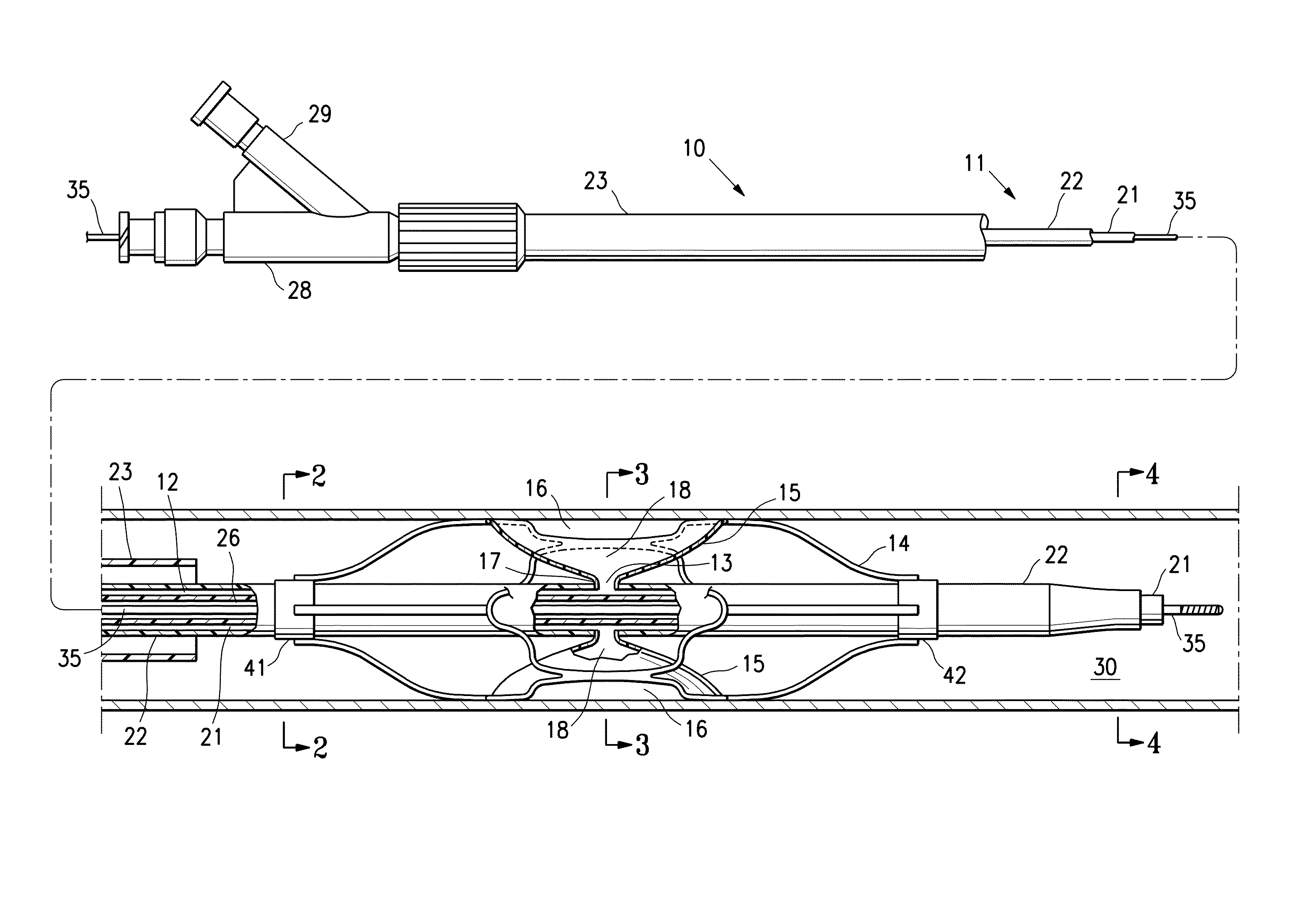 Low profile agent delivery perfusion catheter having a funnel shaped membrane