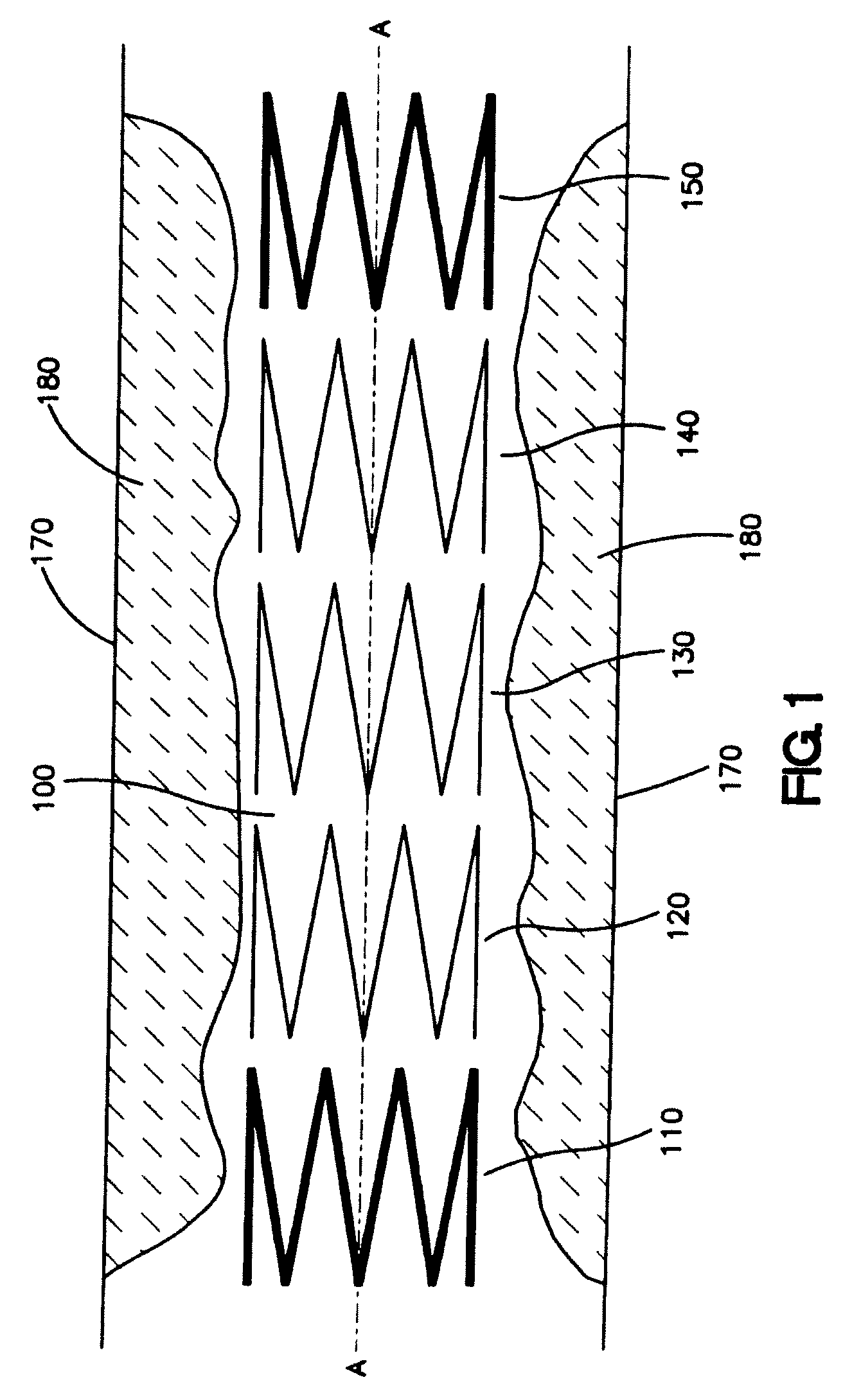 Stent with unconnected stent segments