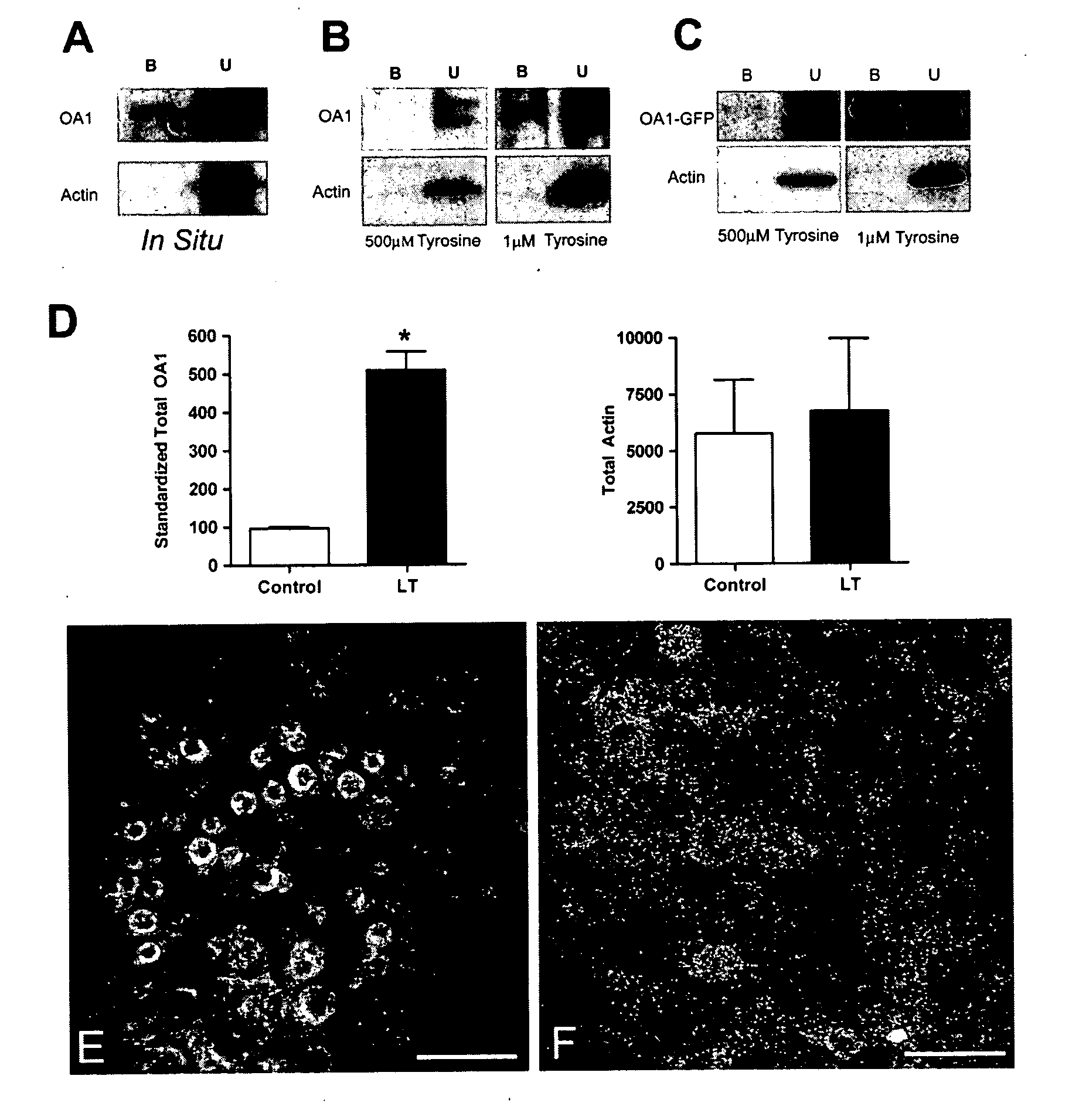 Methods and Compositions for Treating and Identifying Compounds to Treat Age-Related Macular Degeneration