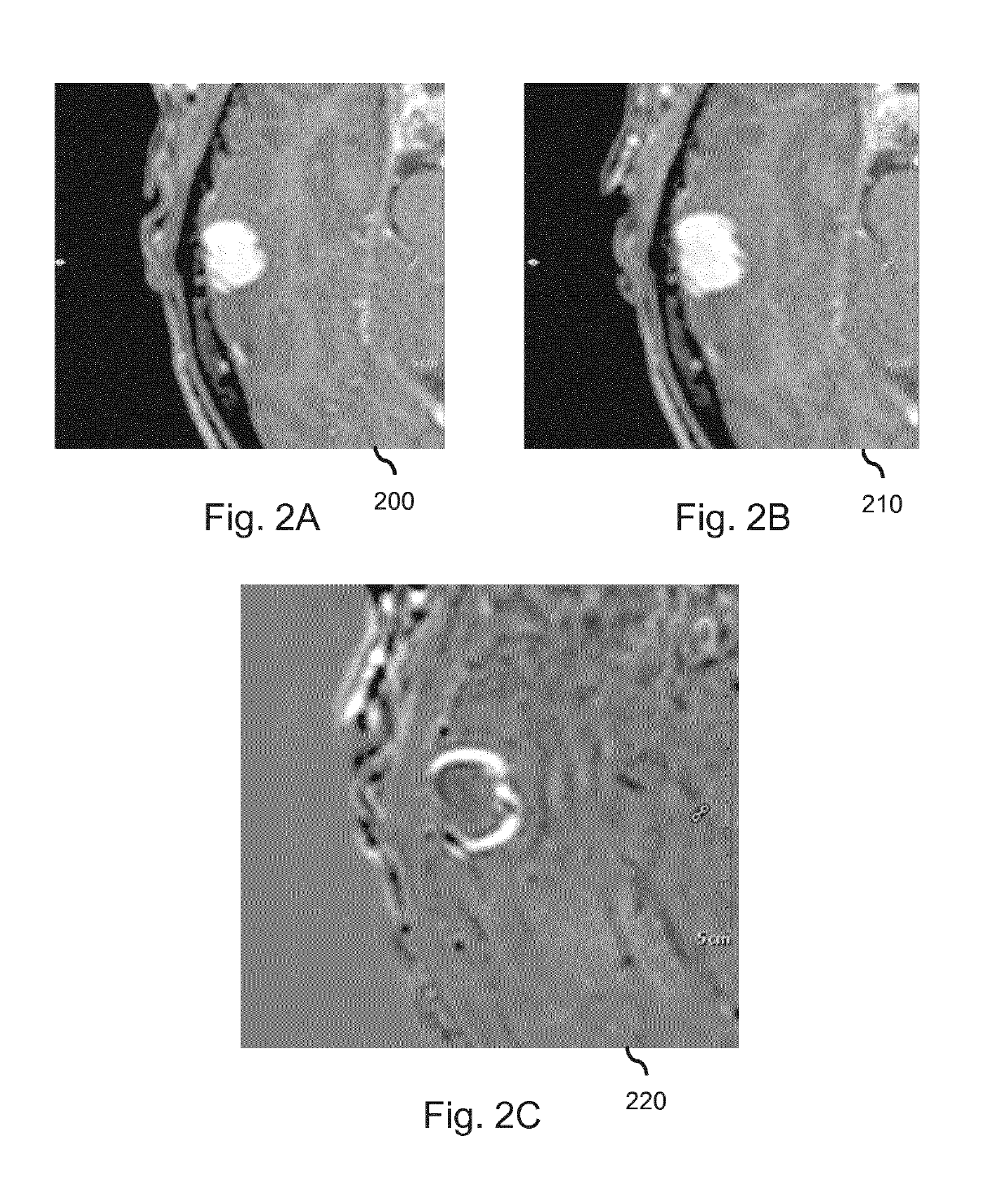 Change detection in medical images