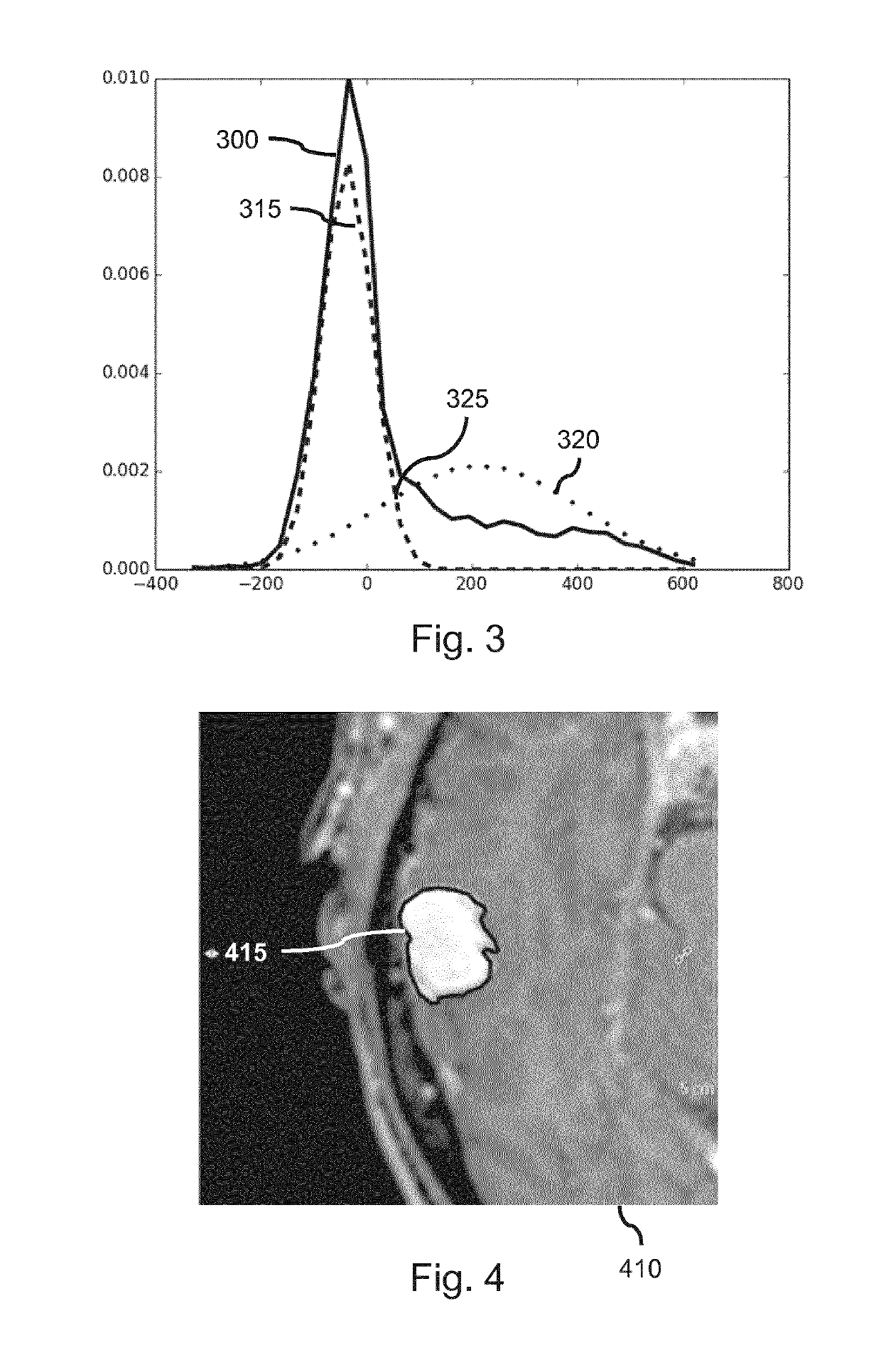 Change detection in medical images