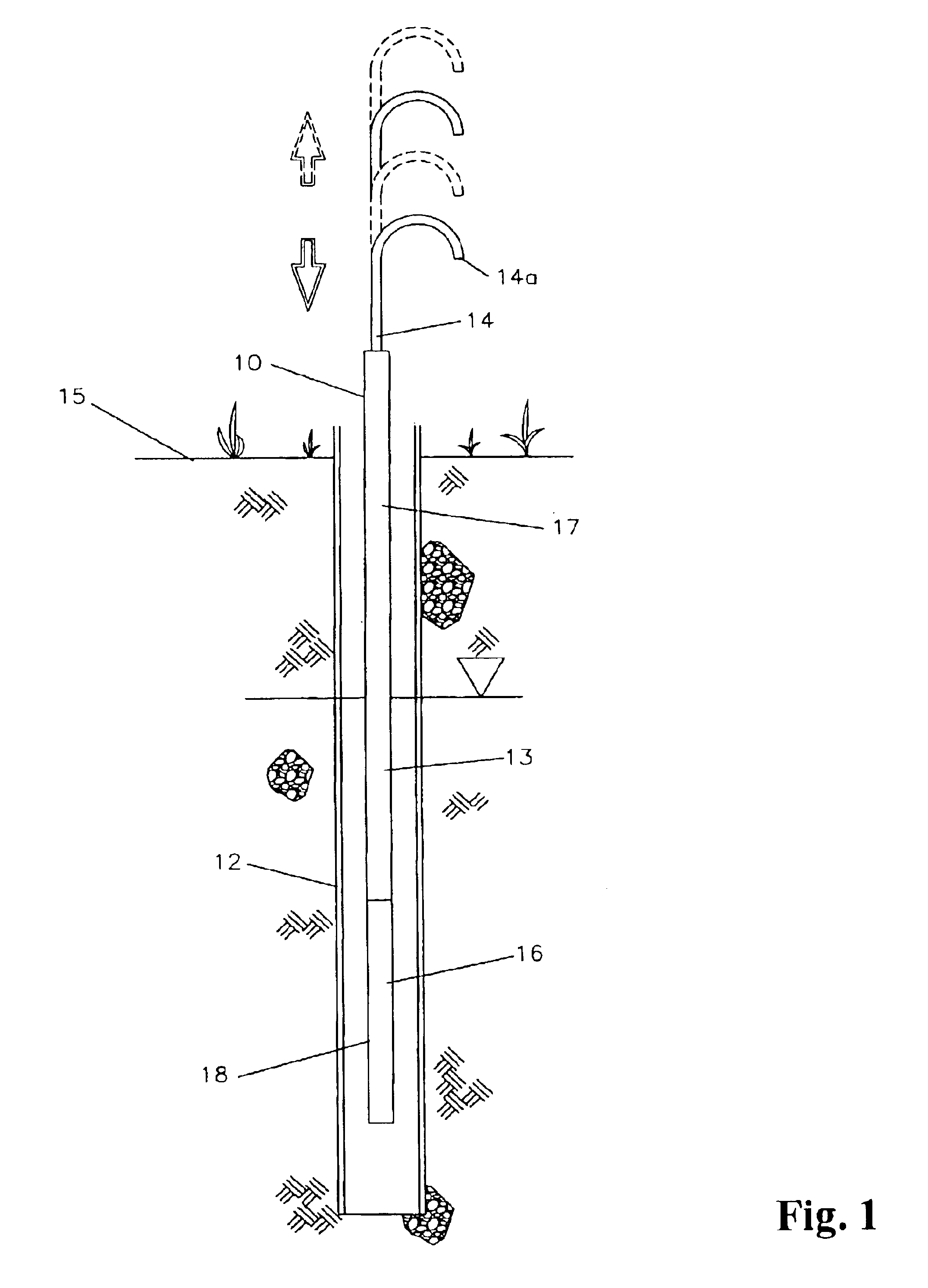 Mechanical bladder pump