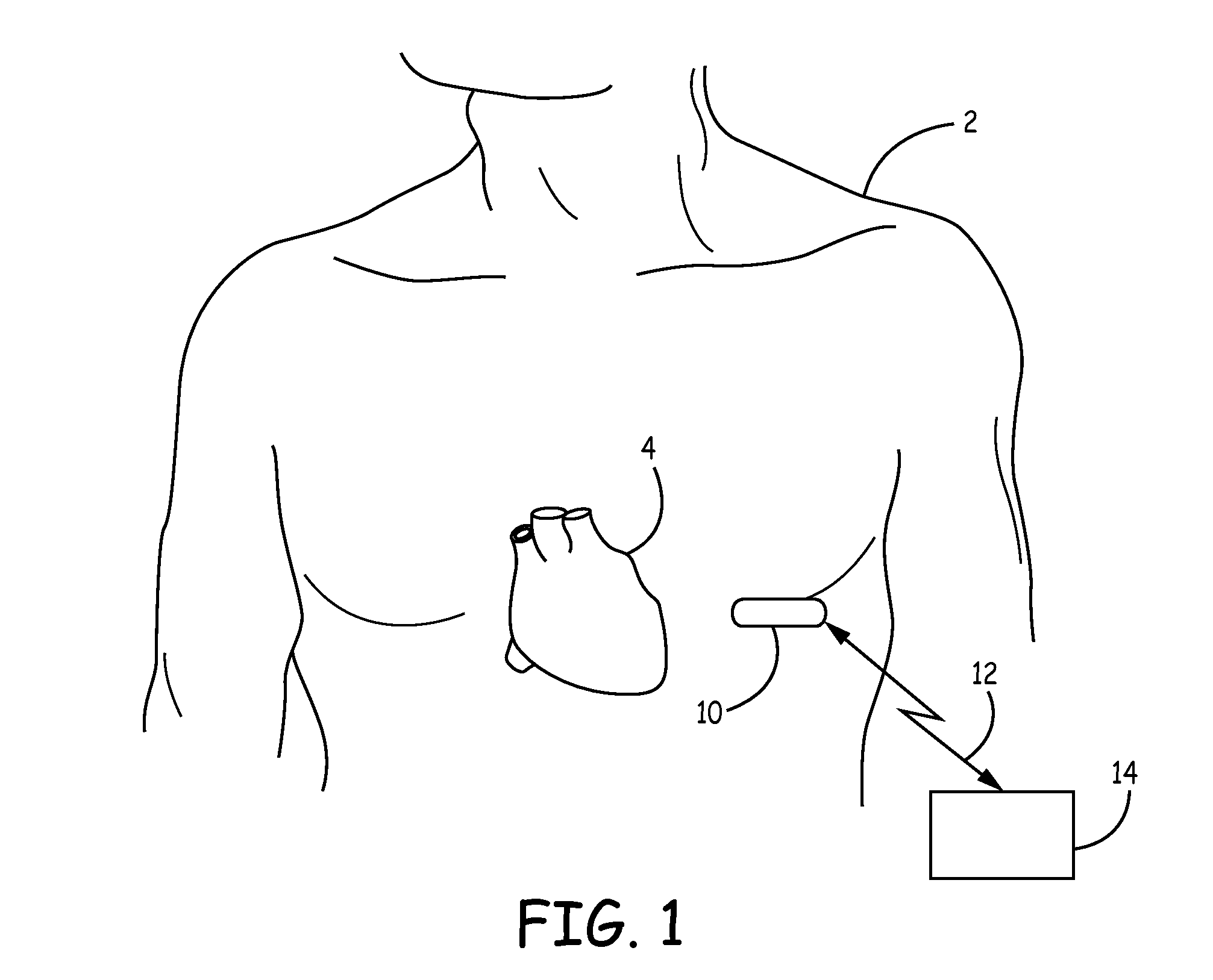 Implantable medical devices with power supply noise isolation