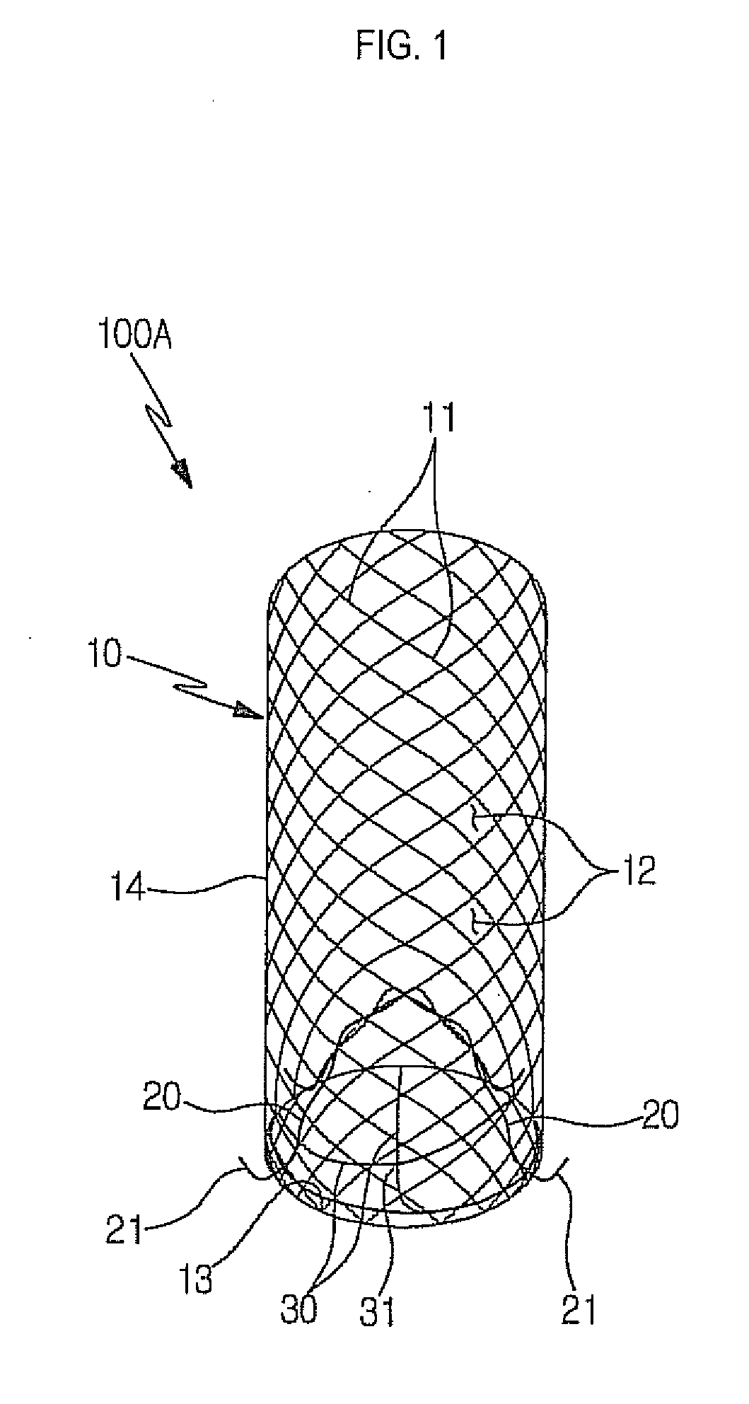 Stent for prostatic urethra expansion