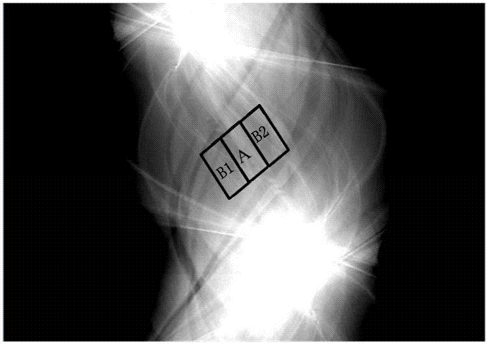 Device and method for recovering original CT projection data, and CT imaging system