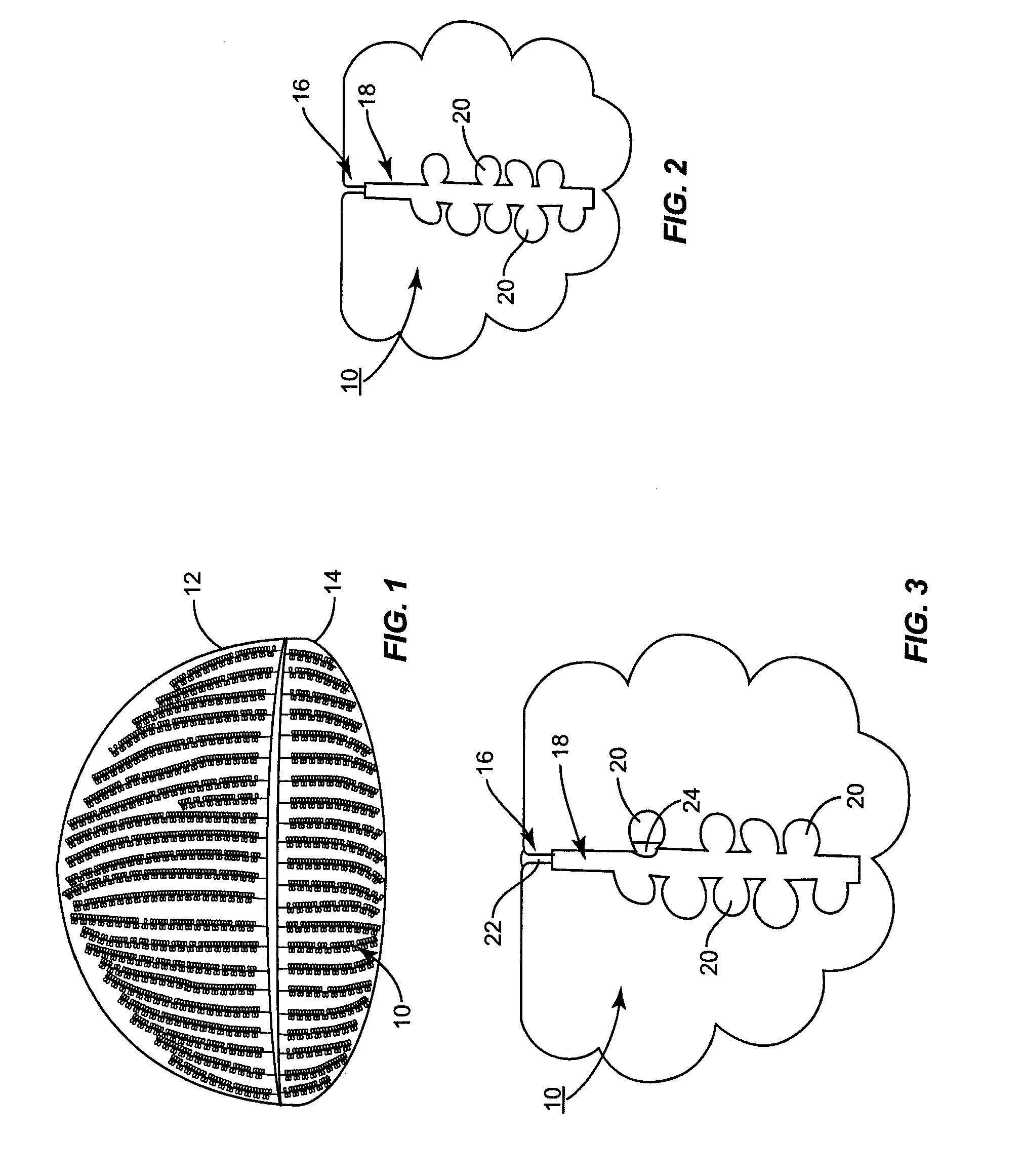 Outer eyelid heat and pressure treatment for treating meibomian gland dysfunction