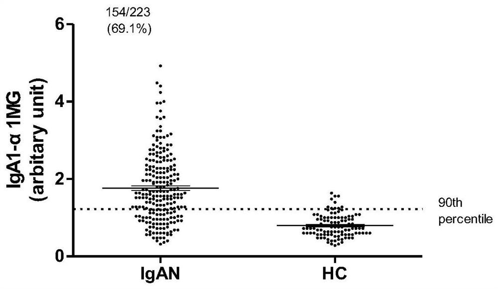 A method for detecting complex Iga1-α1 mg and a kit for non-invasive detection of renal tissue damage