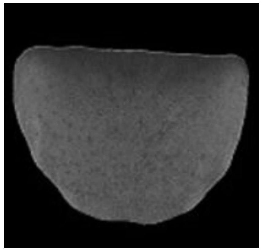 Traditional Chinese medicine tongue quality tenderness identification method based on image restoration and convolutional neural network