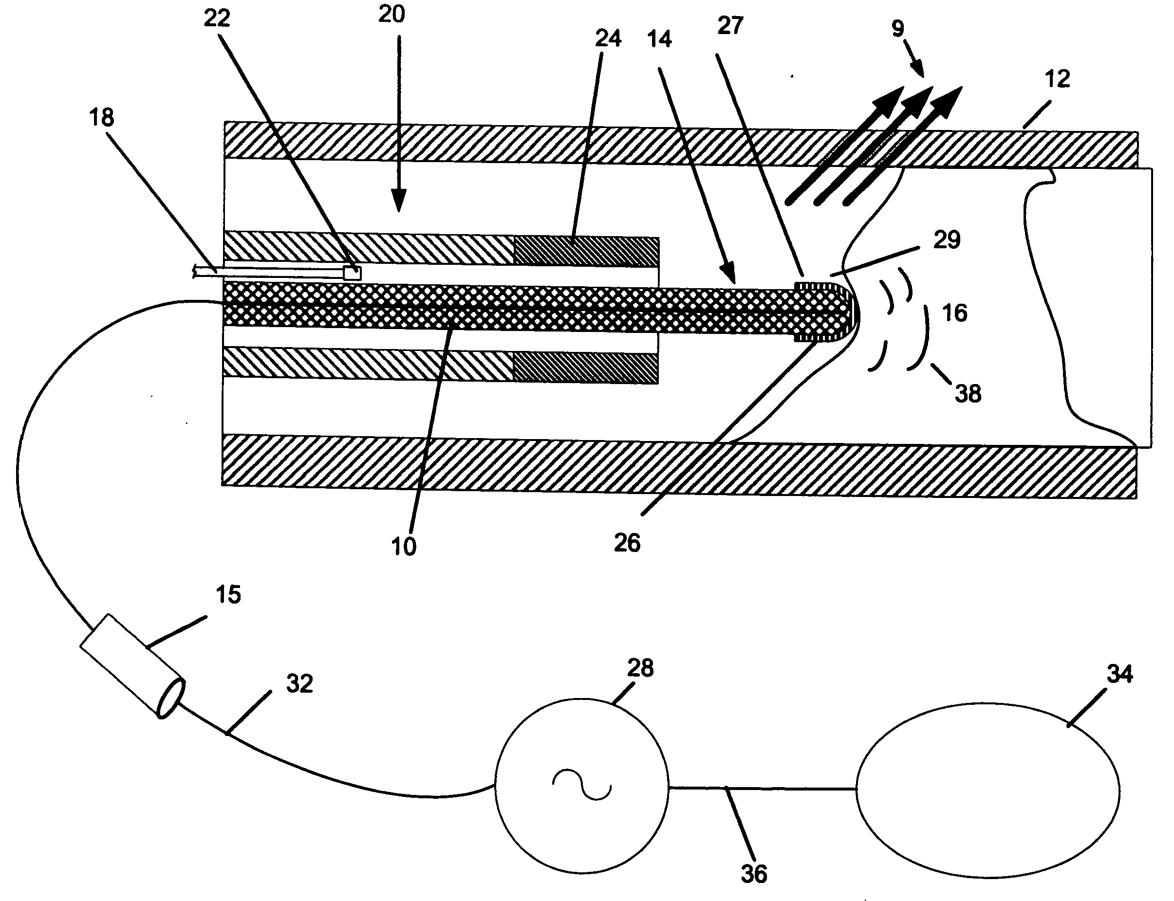 Magnetically Guided Atherectomy