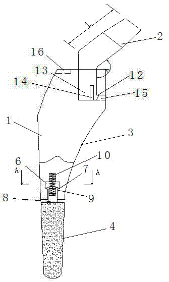 Buffer hip joint