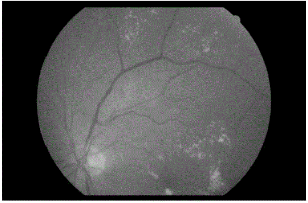 Arteriovenous retinal vessel segmentation method for eye fundus image