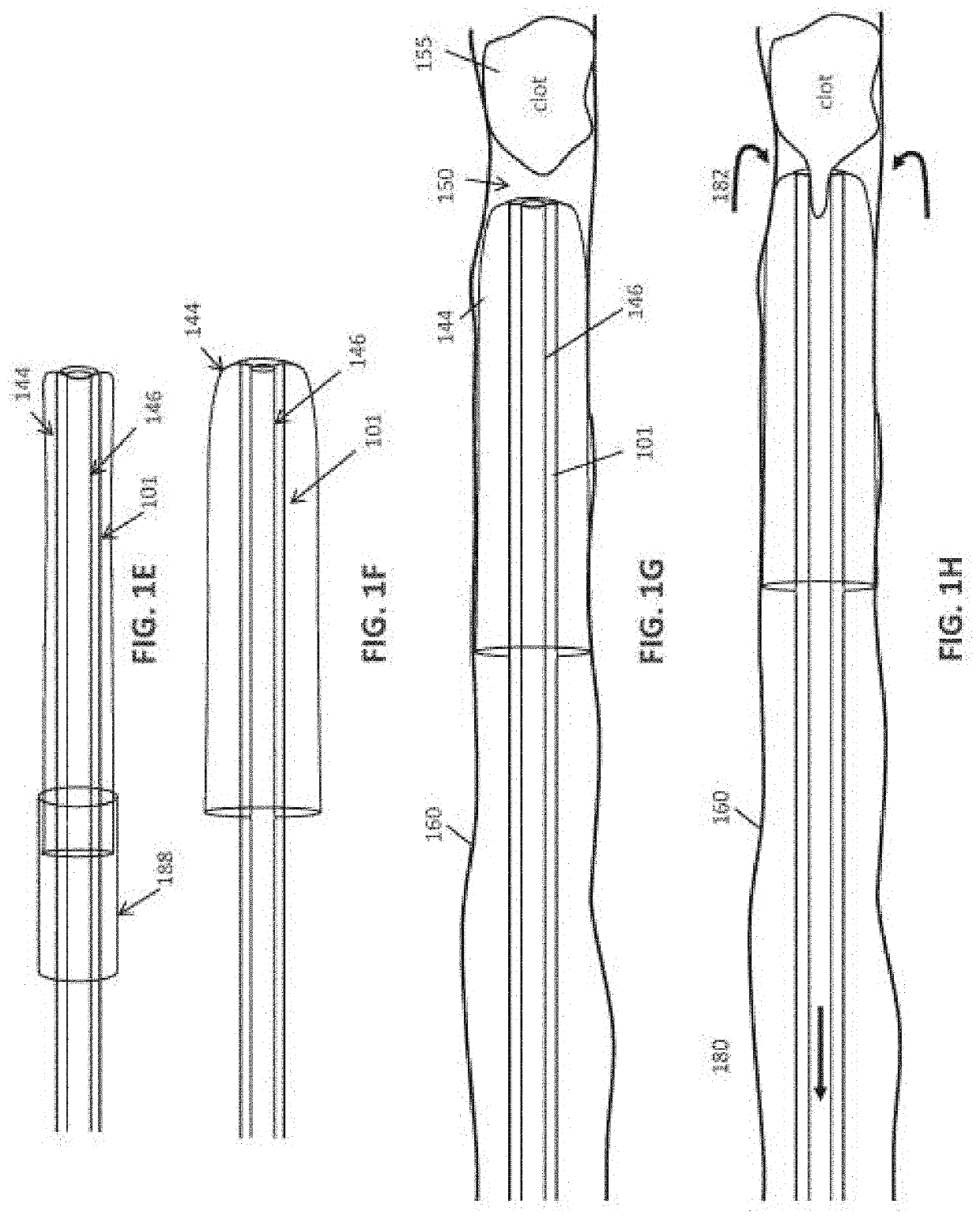 Inverting mechanical thrombectomy apparatuses