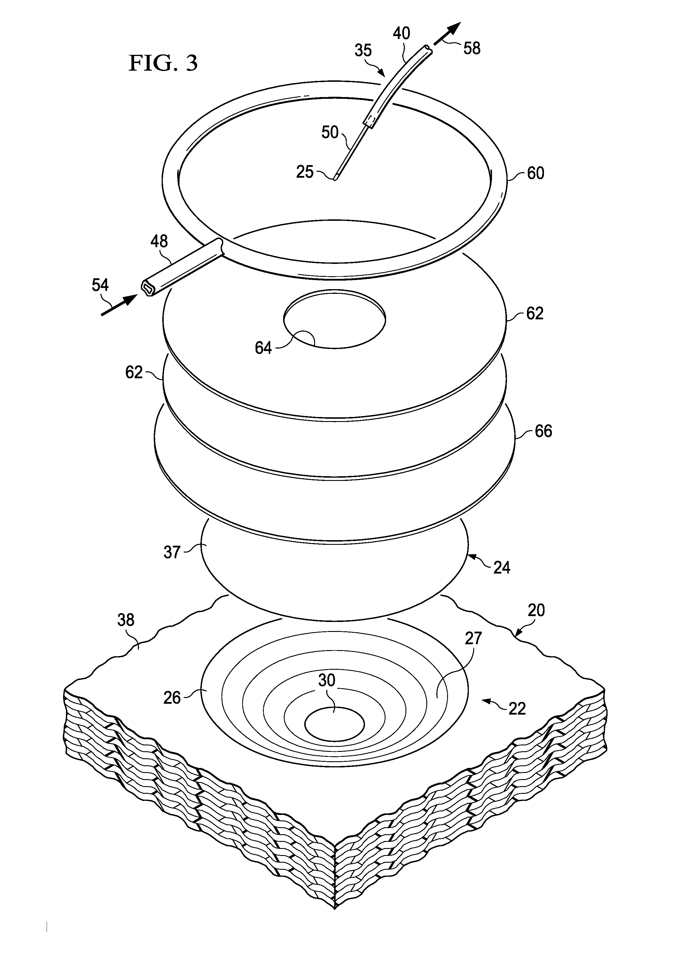 Method and apparatus for reworking structures