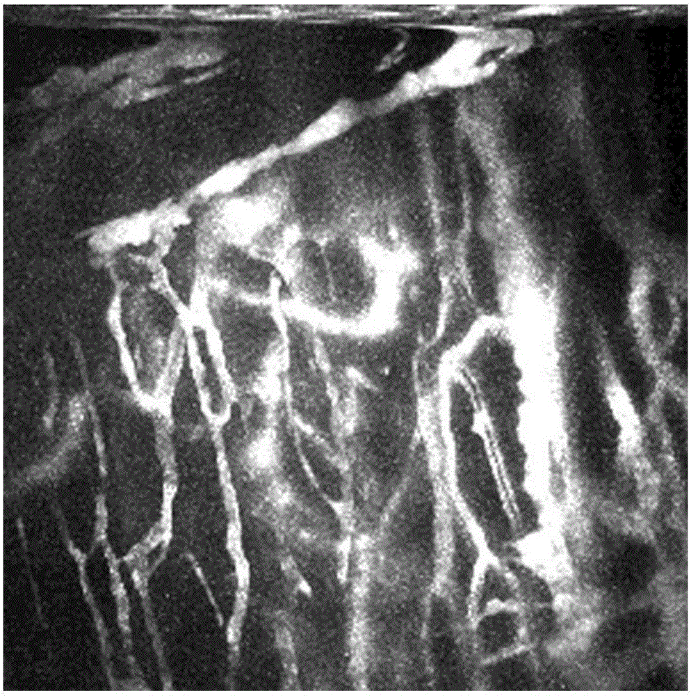 Blood vessel extraction method for live tumor angiogenesis image under optical resolution photo-acoustic microscope