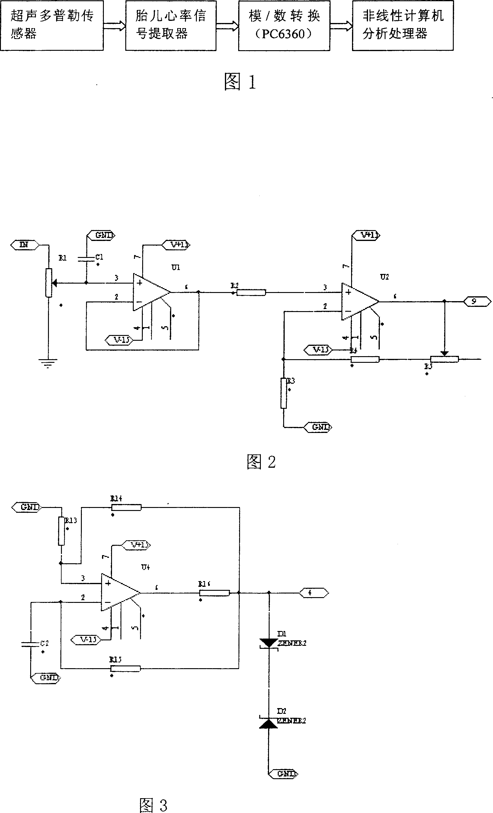 Nonlinear fetal heart rate surveillance instrument