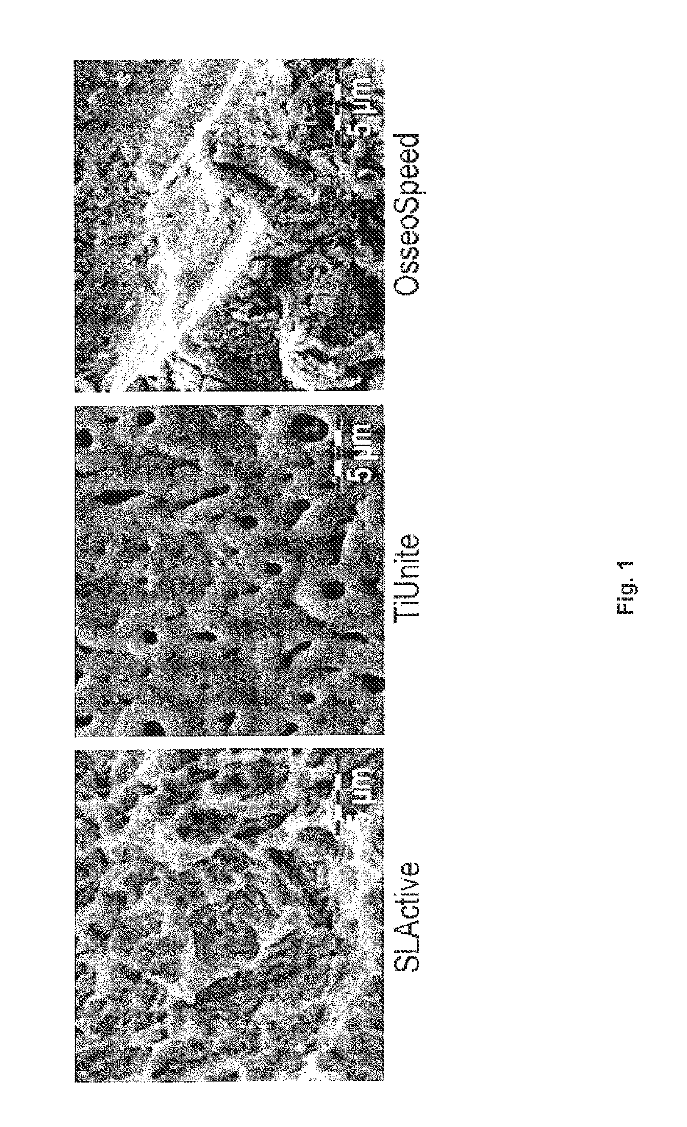 Debridement paste