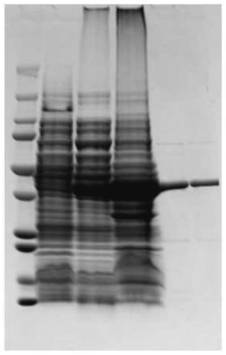 Hybridoma cell strain RSVN4C3 secreting anti-respiratory syncytial virus monoclonal antibody