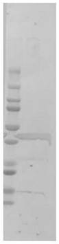 Hybridoma cell strain RSVN4C3 secreting anti-respiratory syncytial virus monoclonal antibody