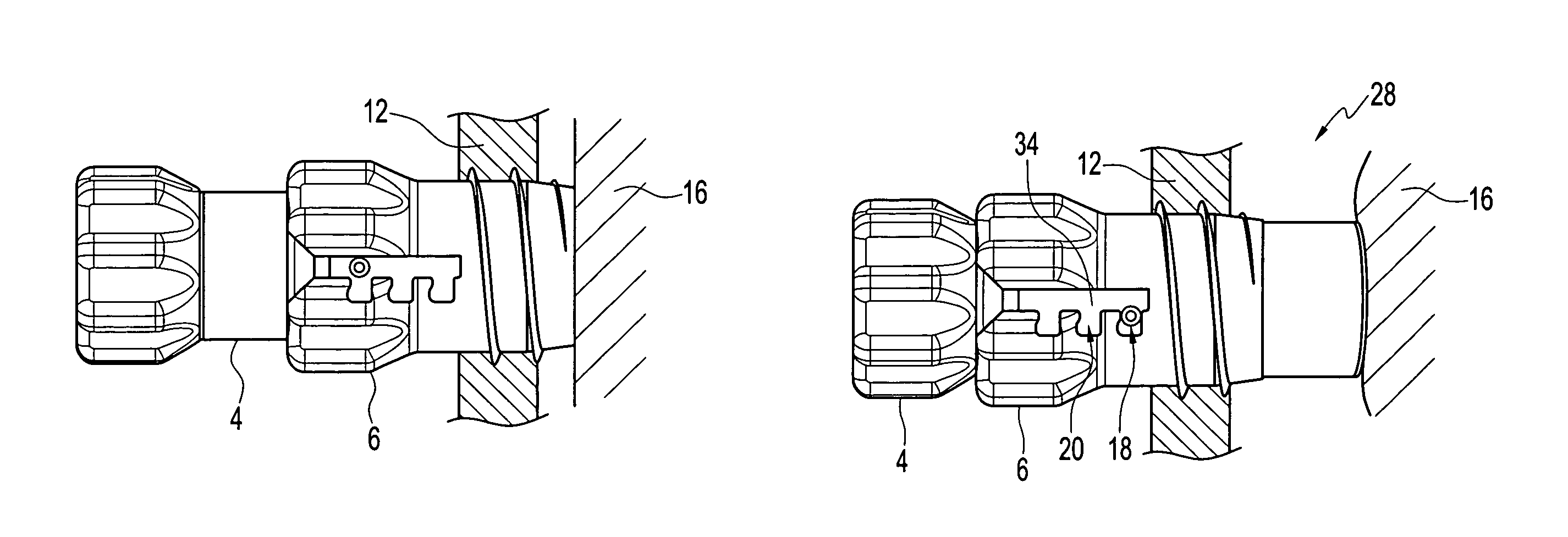 Retracting cannula