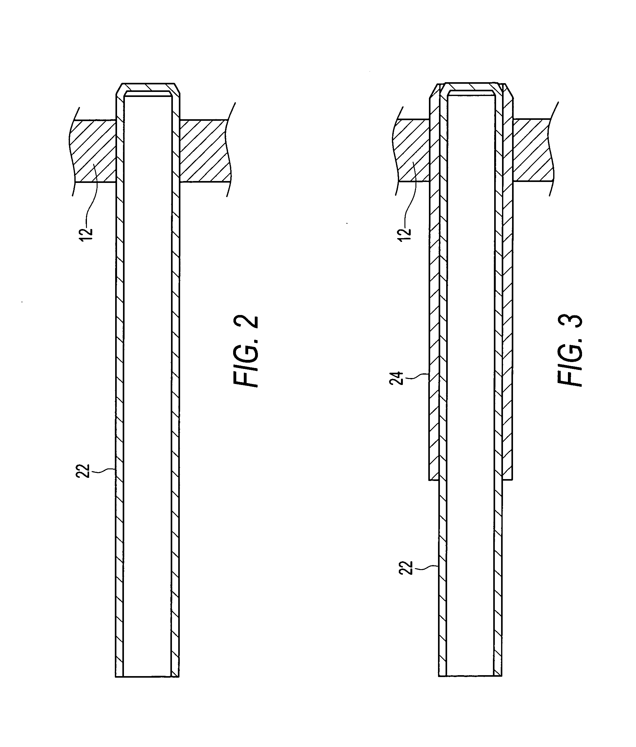 Retracting cannula